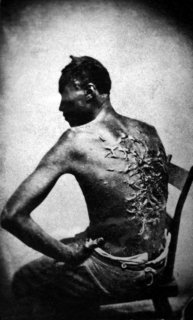 A escravidão deixa marcas. Na pele. Na história. Em nós.